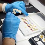 Full Mouth Dental Implants: What Patients Should Know Before Starting
