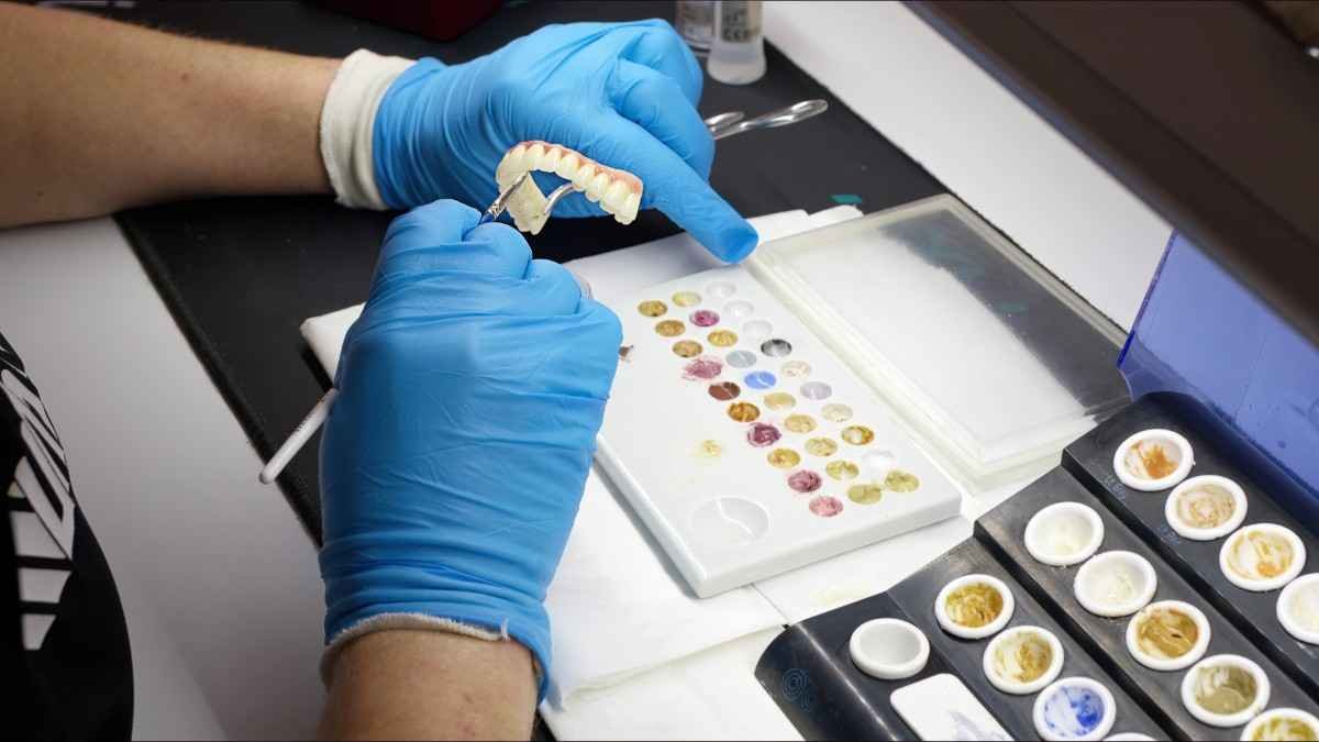Full Mouth Dental Implants: What Patients Should Know Before Starting